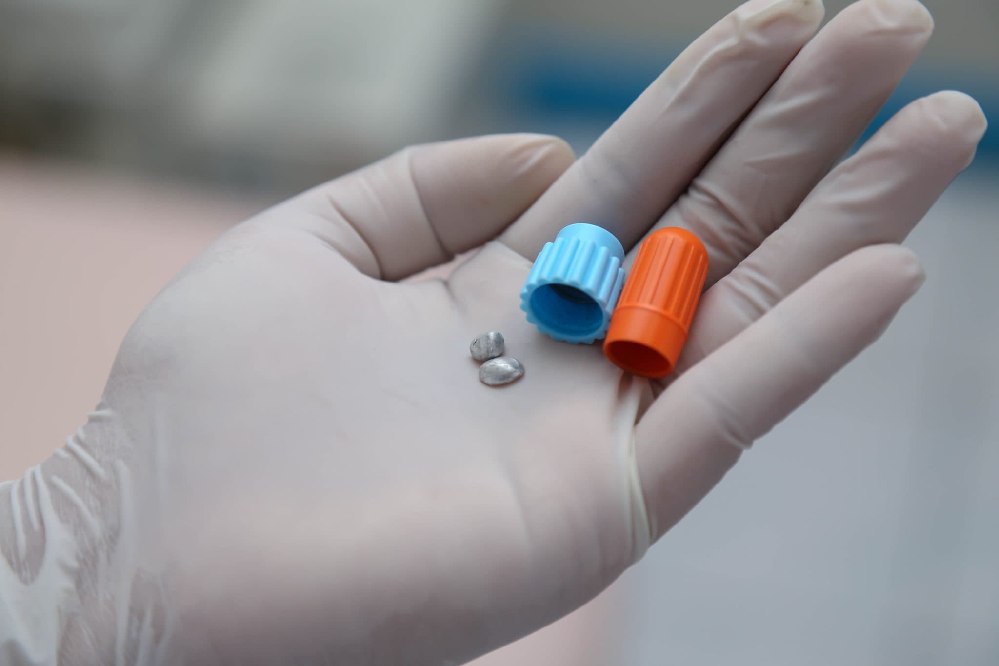 पर्यावरण र स्वास्थ्य सुरक्षाका लागि पारो रहित फिलिङको युग Featured Image